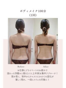 トゥインクル 麻布(twinkle)/港区南麻布/白金/勝山式美容矯正