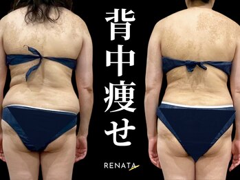 レナータ 渋谷店(RENATA)の写真/【都度払いOK】人目を気にせず広々個室で贅沢な至福の時間を・・・★「RENATAトップクラスエステ６店舗へ」