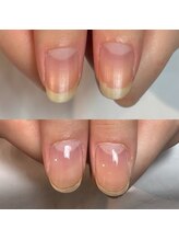 キュア(Cure.)/縦長爪が更に縦長爪に!!