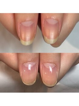 キュア(Cure.)/縦長爪が更に縦長爪に!!