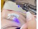 サロンドティス 学芸大学(salon de tis)の写真/【22時まで営業】LEDマツエク導入キャンペーン♪いつもと変わらないお値段でLEDマツエクをお試しできます！