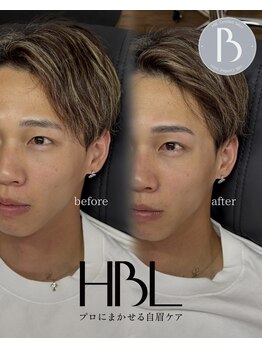 エンテラス 徳島(ENTERAS)/before/after
