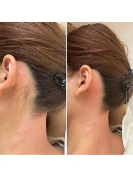 ワックスラボ(WAXLAB)/うなじWAX