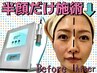 品川で人気のホワイトニング【オキシジェネオ】リフトアップ毛穴シミ改善する