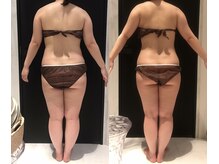 リボディ 表参道(An re Body)/before→after