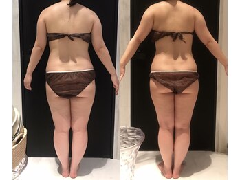 リボディ 表参道(An re Body)/before→after