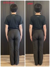 深層整筋サロン/施術before＆After(50代女性)