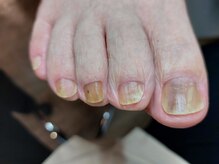 爪切り屋 足楽/爪切りが苦手でも