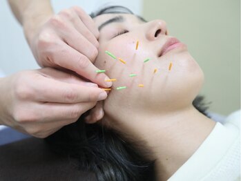 つなぐ/小顔・むくみ改善【美容鍼】