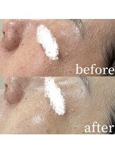 コスメティック雅/【肌の赤みを鎮静】