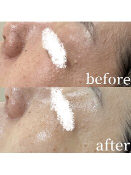 コスメティック雅/【肌の赤みを鎮静】