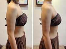 アニバーサリー(Anniversary)/ブライダル