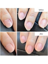 ケアプラス(care plus)/ハンドネイルケア