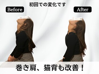 ハリユナイテッド 原宿鍼灸 整体院(HALI UNITED)/巻き肩・猫背改善!