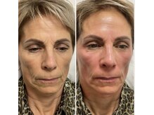 ティーボックスボーテ(TBOX beaute)/