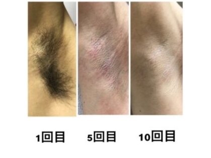 レヴィート(Revept)の写真