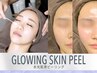【新規】【大人のくすみ肌】透明感ピーリング|ハーブピーリングなど変更可