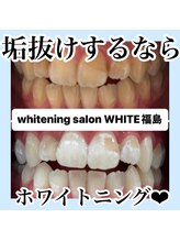 ホワイトニングサロン ホワイト(WHITE)/垢抜けするならホワイトニング