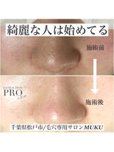 ムク(MUKU)/綺麗な人は始めてる