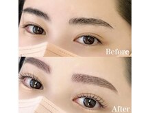 レピア 高槻店/韓国式LEPIA Before&After