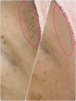 プチ プロムナード(Petit Promenade)/美肌フェイスワックス