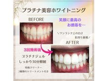 ホワイトニングプラス(Whitening+)の雰囲気（人気のプラチナ美容ホワイトニング♪是非ご体感ください♪）