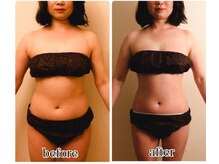 インディバジェム(GEM)/ビフォーアフター