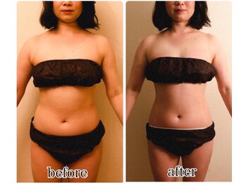 インディバジェム(GEM)/ビフォーアフター