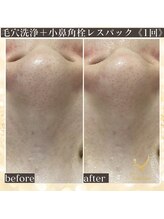 サロン カピリナ(salon Kapilina)/【before→after】