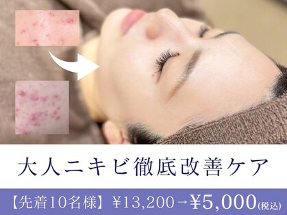 エピア 豊田店(Epia)の写真