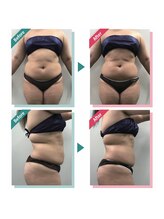 レニフォーメン(reni for men)/【お腹集中】