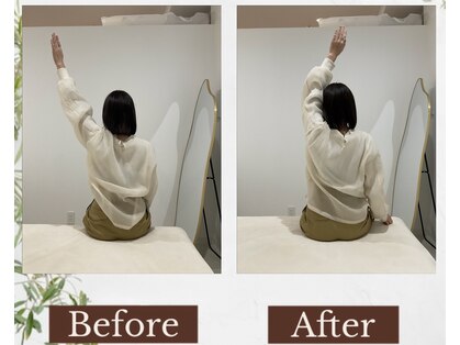 ルノア 梅田院(LUNOA)の写真