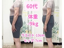 トータルボディーケアステーション 岡山院/60代　耳ツボ　見た目が激変