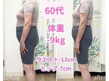 トータルボディーケアステーション 岡山院/60代　耳ツボ　見た目が激変