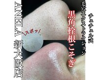 アネラ(ANELA)の雰囲気(黒ずみ 毛穴 根こそぎ スポっ!)