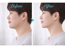 アプロ(Aphro)/男性フェイスケア