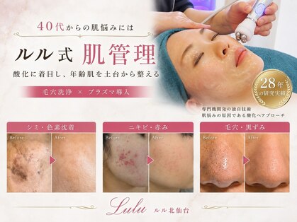 ルル 北仙台の写真