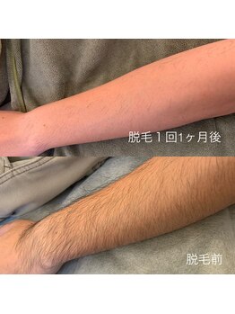 フームー シム(fuumuu Shim)/結果重視の方はぜひ!