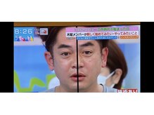 フェイシャルコルギ ヒロ(Hilo)の雰囲気（TBSラヴィット生放送に出演、コルギ効果を絶賛されました！！）