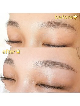 アンドミラ(&mira)/HBLビフォーアフター☆