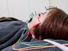 ☆☆【学割U24☆☆【肌質改善＆むくみ改善】美容鍼☆美容パック付き♪￥4,000
