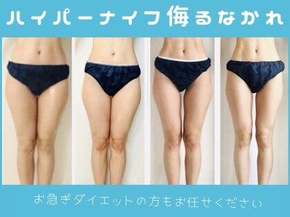 エムプリュ(M.plus)の写真
