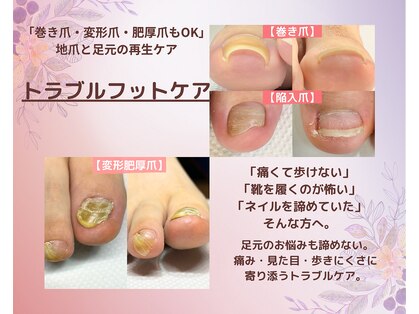 ナユネイル(na_yu.nail)の写真