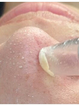 コンフィ(Comfy)/韓国式3D毛穴洗浄