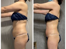 フュース(Futh)/ダイエット/むくみ改善