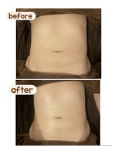 アネクル(ANECUL)/