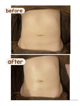 アネクル(ANECUL)/