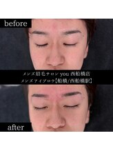 ユー 西船橋店(you)/ビフォーアフターお写真