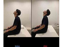 巡 上野御徒町(MEGURU)/ビフォーアフター　上野肩こり