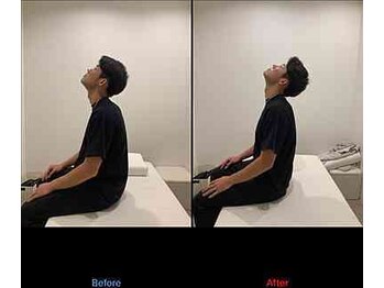 巡 上野御徒町(MEGURU)/ビフォーアフター　上野肩こり